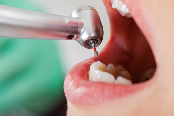 Best Cracked Tooth Emergency Dentist  in East Jordan, MI